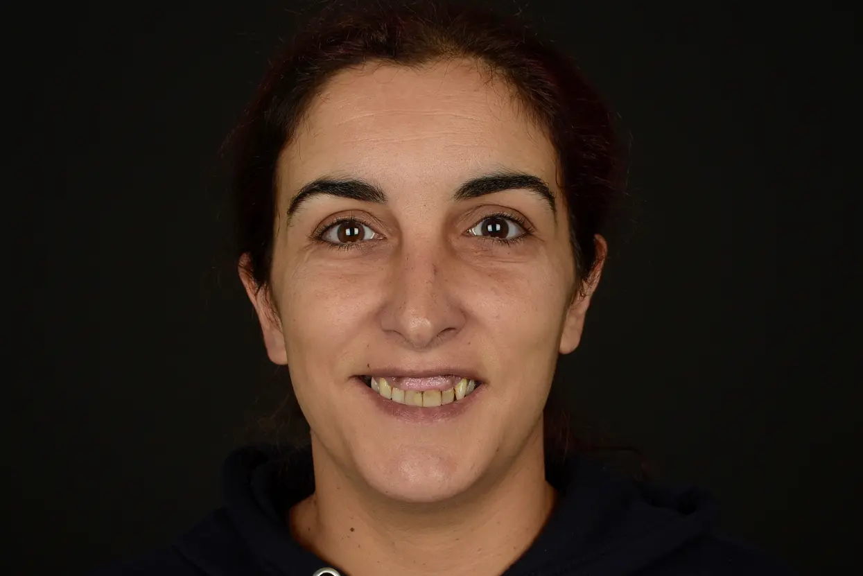 Paciente Clínica dental en Pontevedra - Dental Studio - María Loira