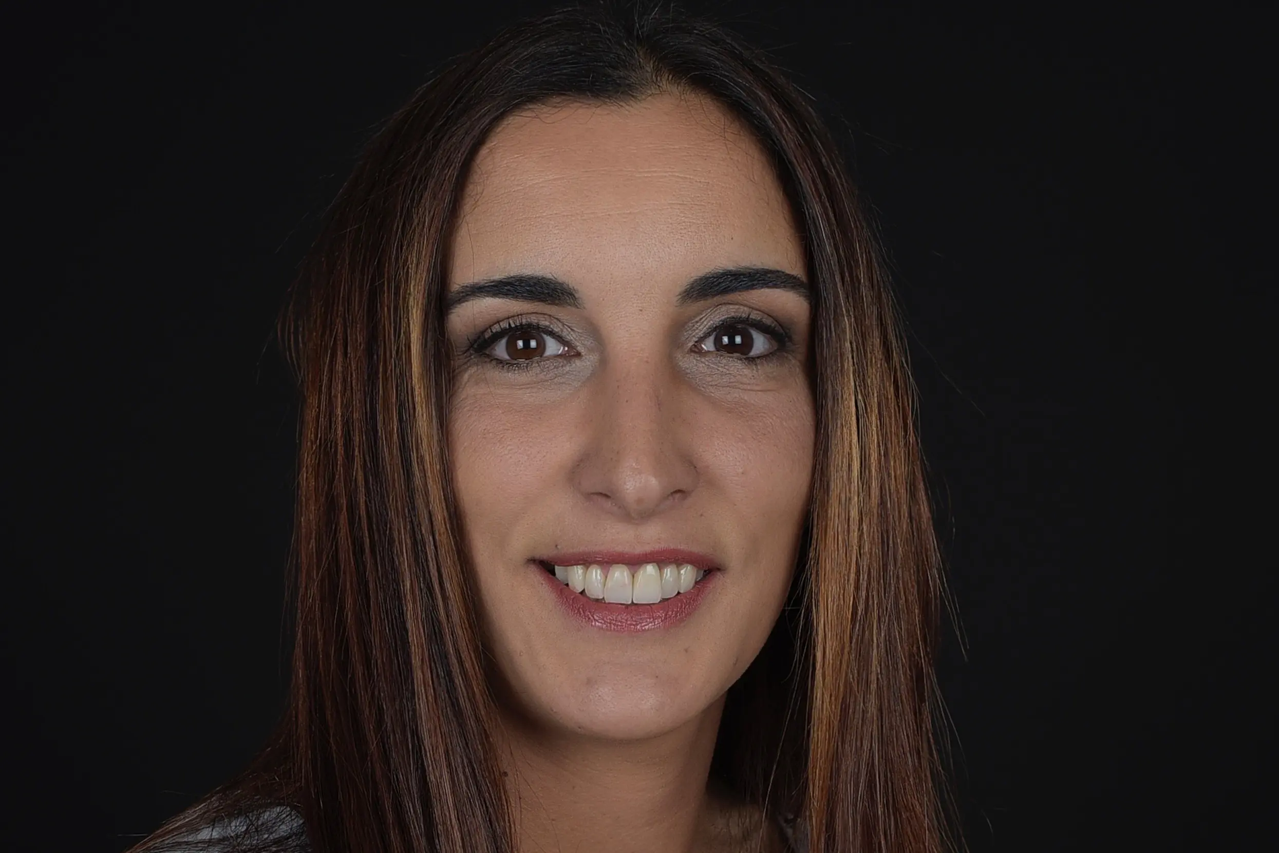 Paciente Clínica dental en Pontevedra - Dental Studio - María Loira